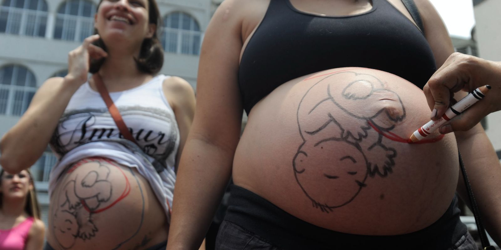 Causas sociais e estruturais que levam mulheres a cesarianas no Brasil