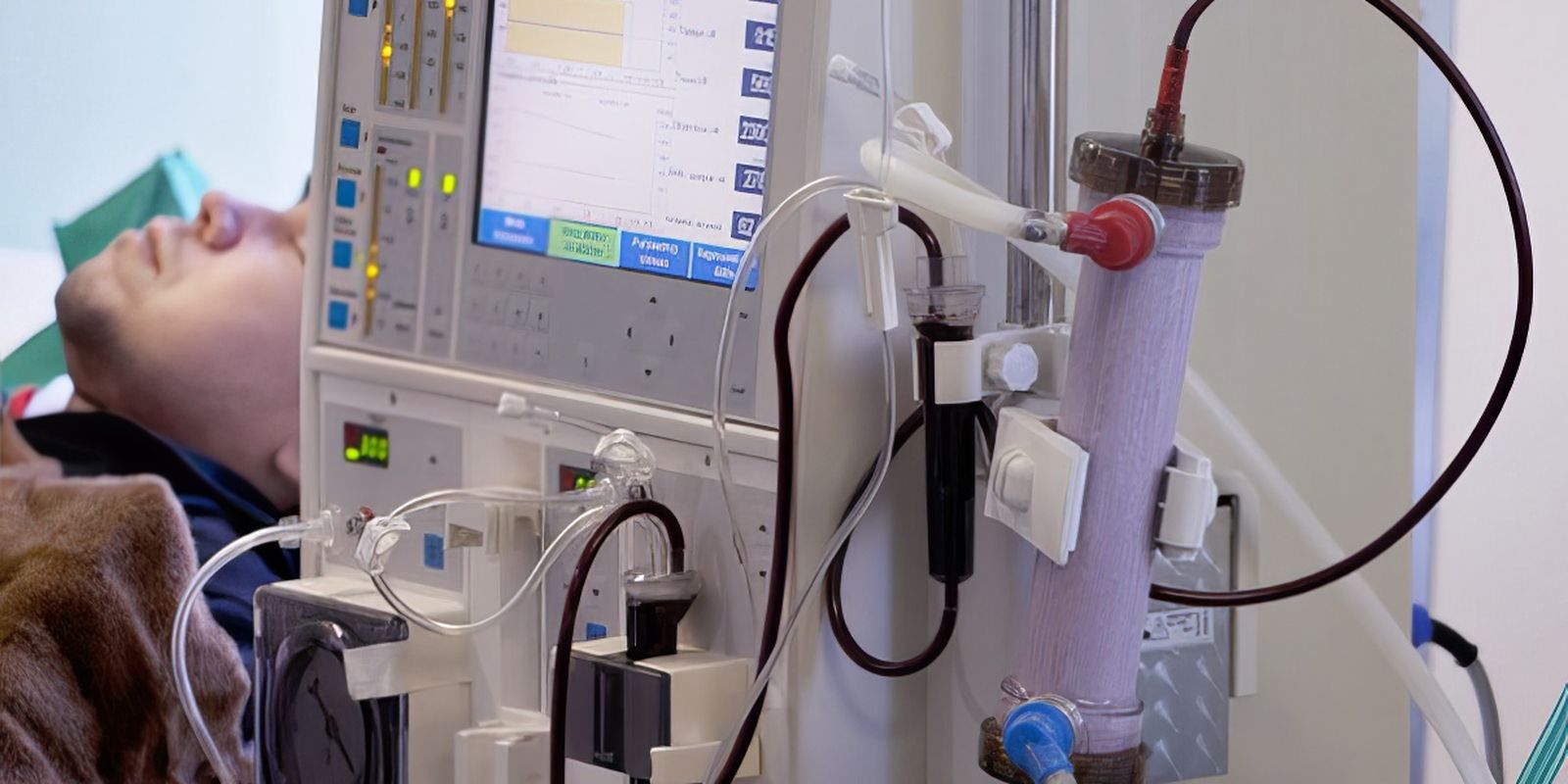 Alerta sobre o subdiagnóstico da doença renal crônica no Brasil
