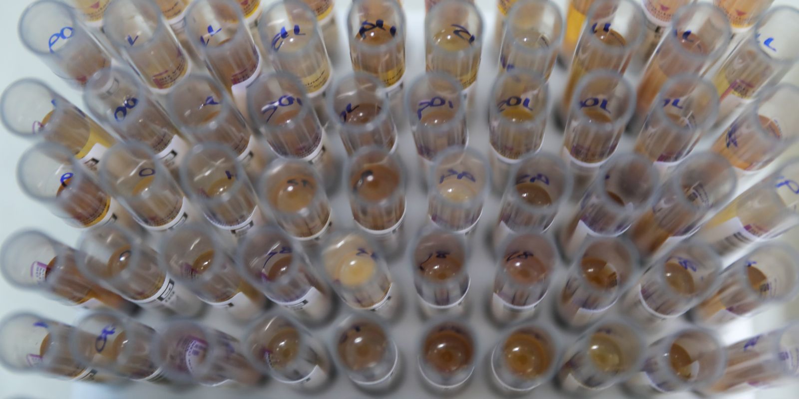 Medicamento do SUS reduz significativamente casos de malária no Brasil em 2025